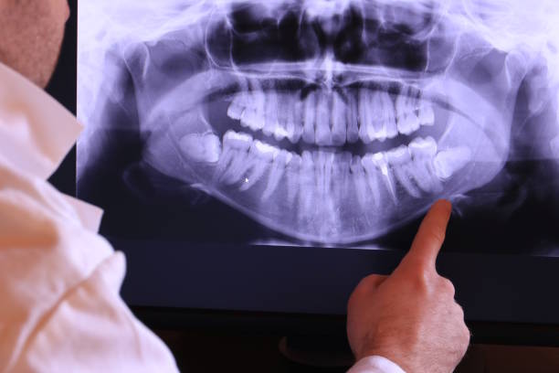 Best Knocked-Out Tooth Emergency  in Long Prairie, MN